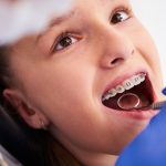 Ankara Ortodonti, Ankara Şeffaf Plak, Ankara Invisalign, Ankara Diş Teli, Ankara Çene Cerrahisi, Ankara Gülüş Estetiği, Ankara Diş Beyazlatma