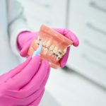 Ankara Ortodonti, Ankara Şeffaf Plak, Ankara Invisalign, Ankara Diş Teli, Ankara Çene Cerrahisi, Ankara Gülüş Estetiği, Ankara Diş Beyazlatma